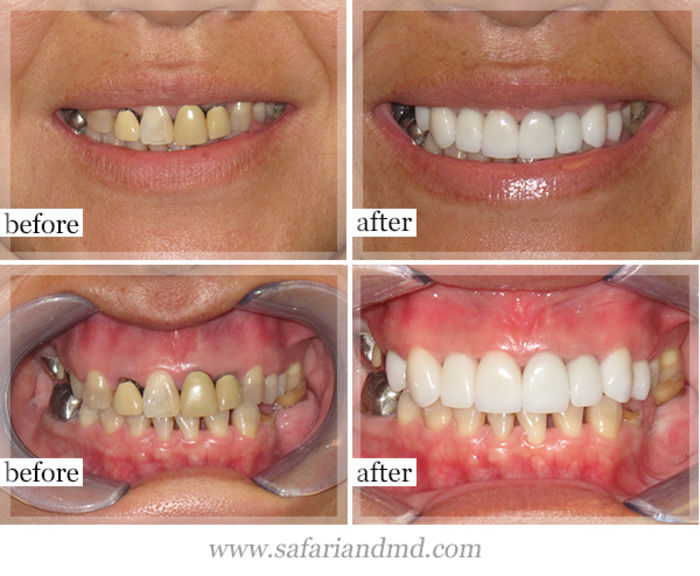 List of 10 Most Common Dental Treatments A Listly List