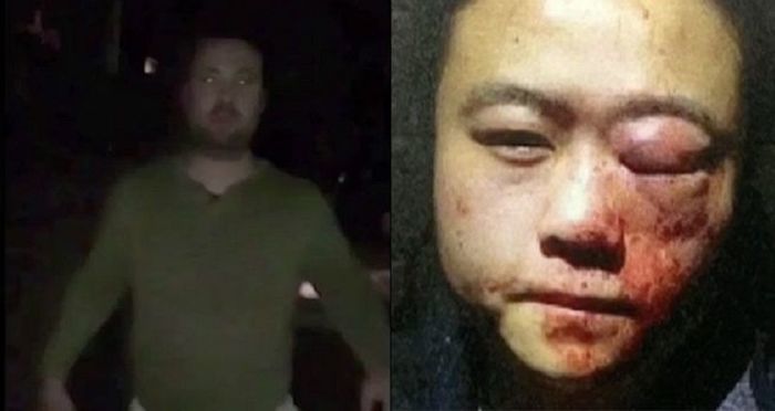 Asian Woman Brutally Assaulted in Sydney After Racist Tells Her to 'Go Back to China'