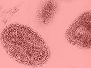 Smallpox