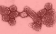 Influenza