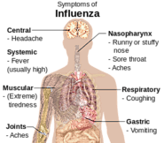 Influenza