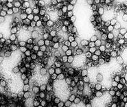 Yellow Fever Virus