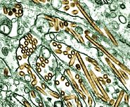 Influenza A (Avian Flu)