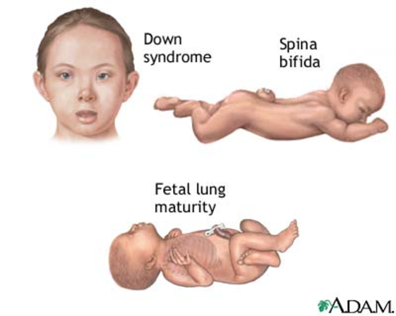 Mild case of asperger s syndrome in adults